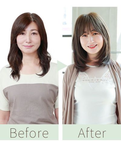 GB-01-mrs-beforeafter