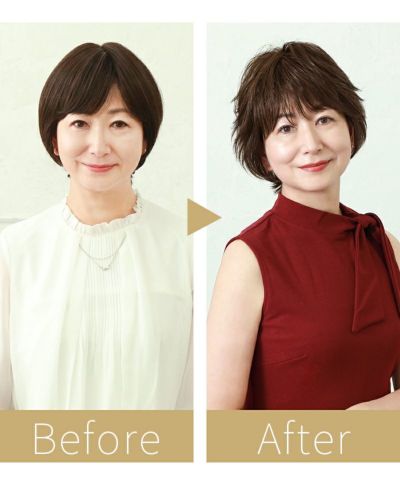 bc-100-beforeafter_mrs
