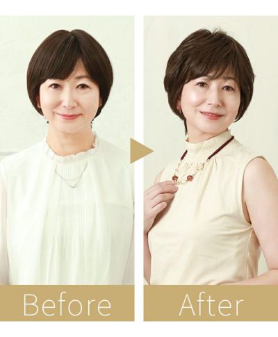 brb-100-beforeafter_mrs