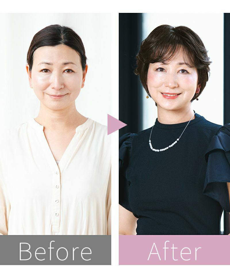 帽子ウィッグ（リラックス）【リズムカールショート】BO-07 モデル着用beforeafter